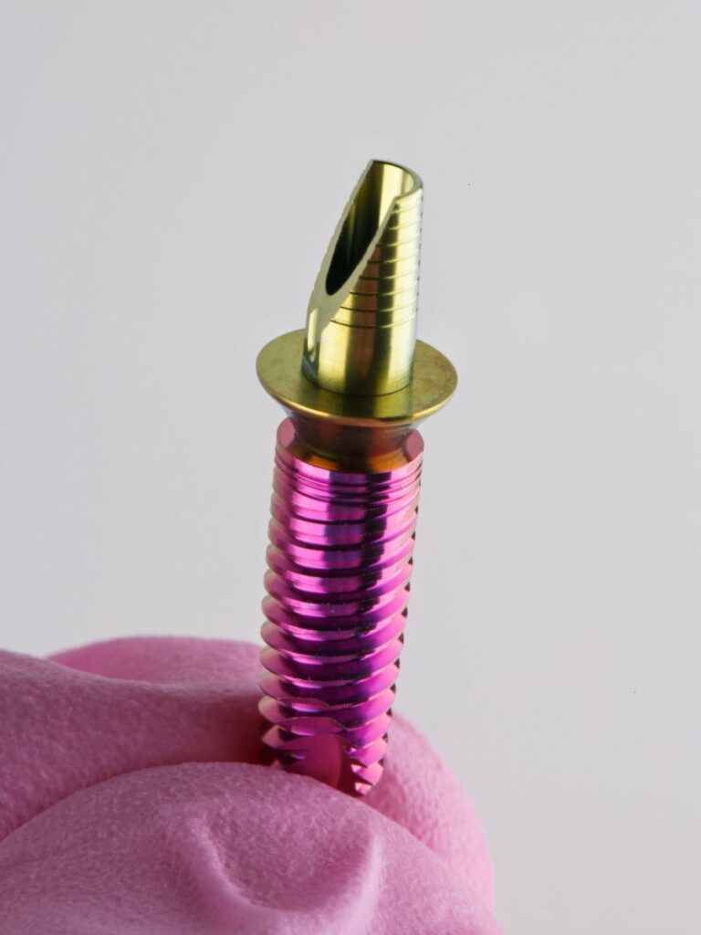 Are dental implants worth it? This image shows a mockup of a dental implant.