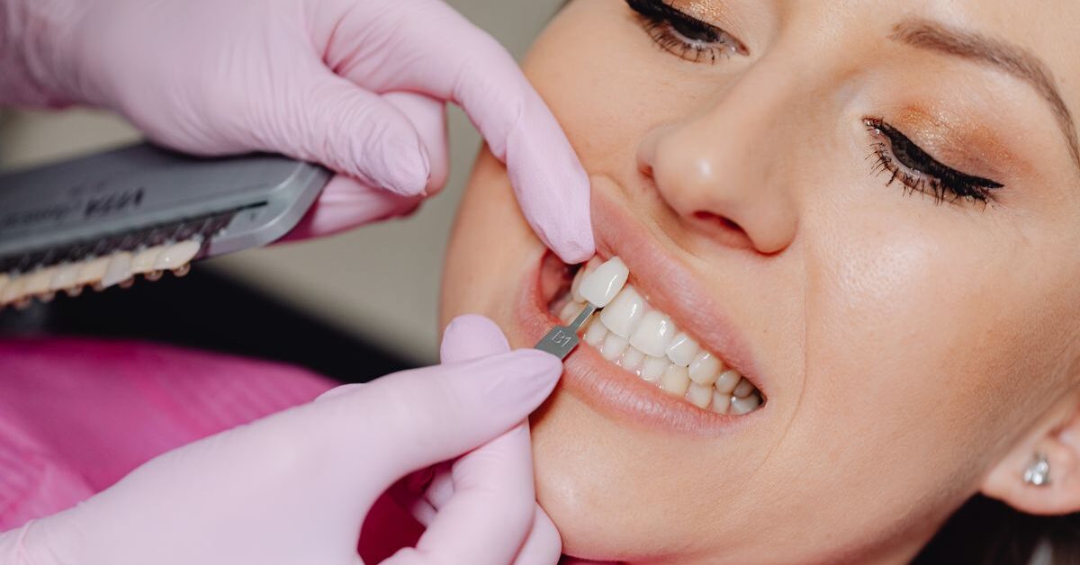 a person with gloves touching a woman's mouth to put on permanent veneers