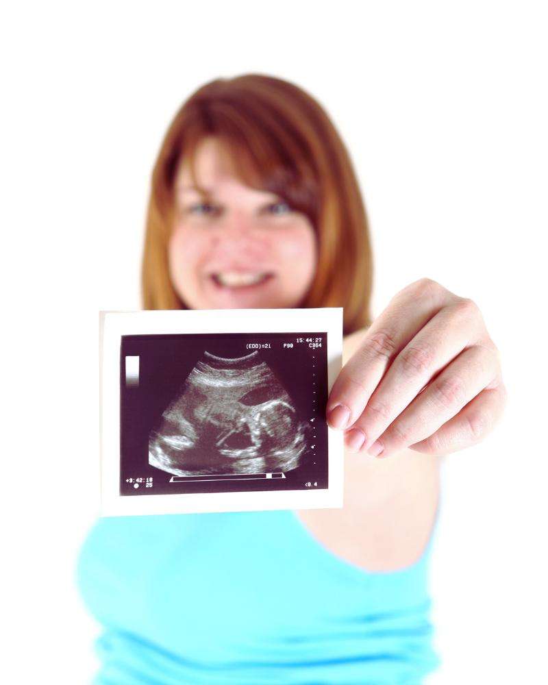 Woman with red hair and a blue shirt showing a close up picture of a sonogram and probably thinking about pregnancy at 43 statistics