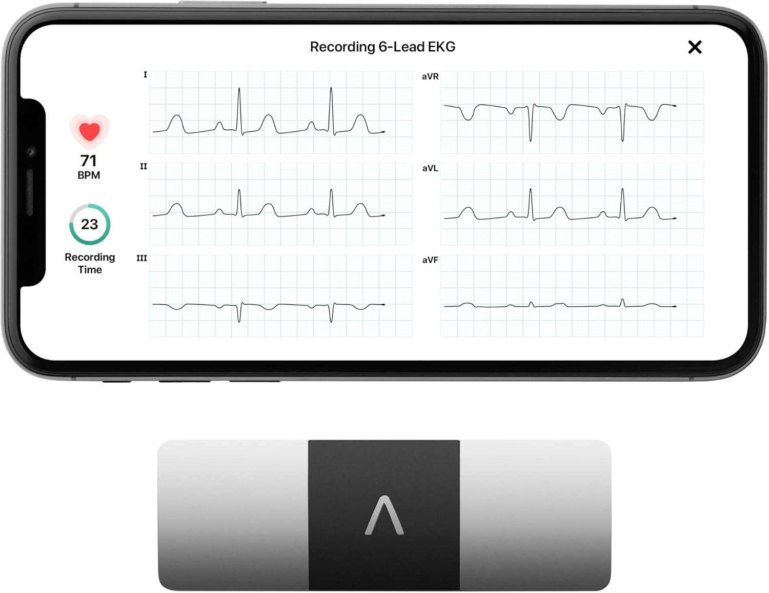 a screen shot of a device designed to monitor your heart 