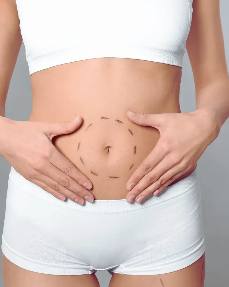 a woman in white underwear with marks on her stomach