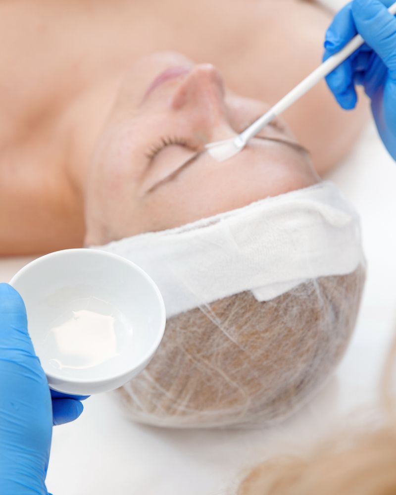 a person getting a facial treatment after considering microneedling vs chemical peel